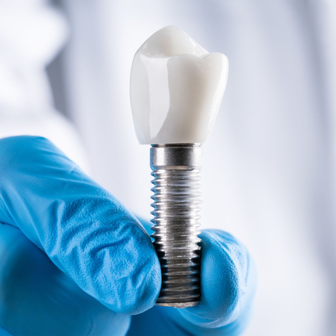 Advanced Dental Implants
