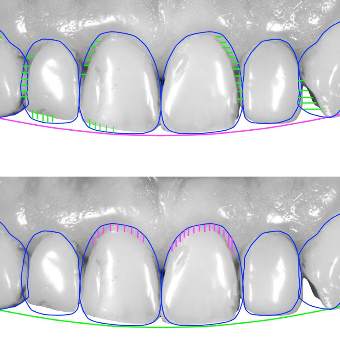 Digital Dental Scanning
