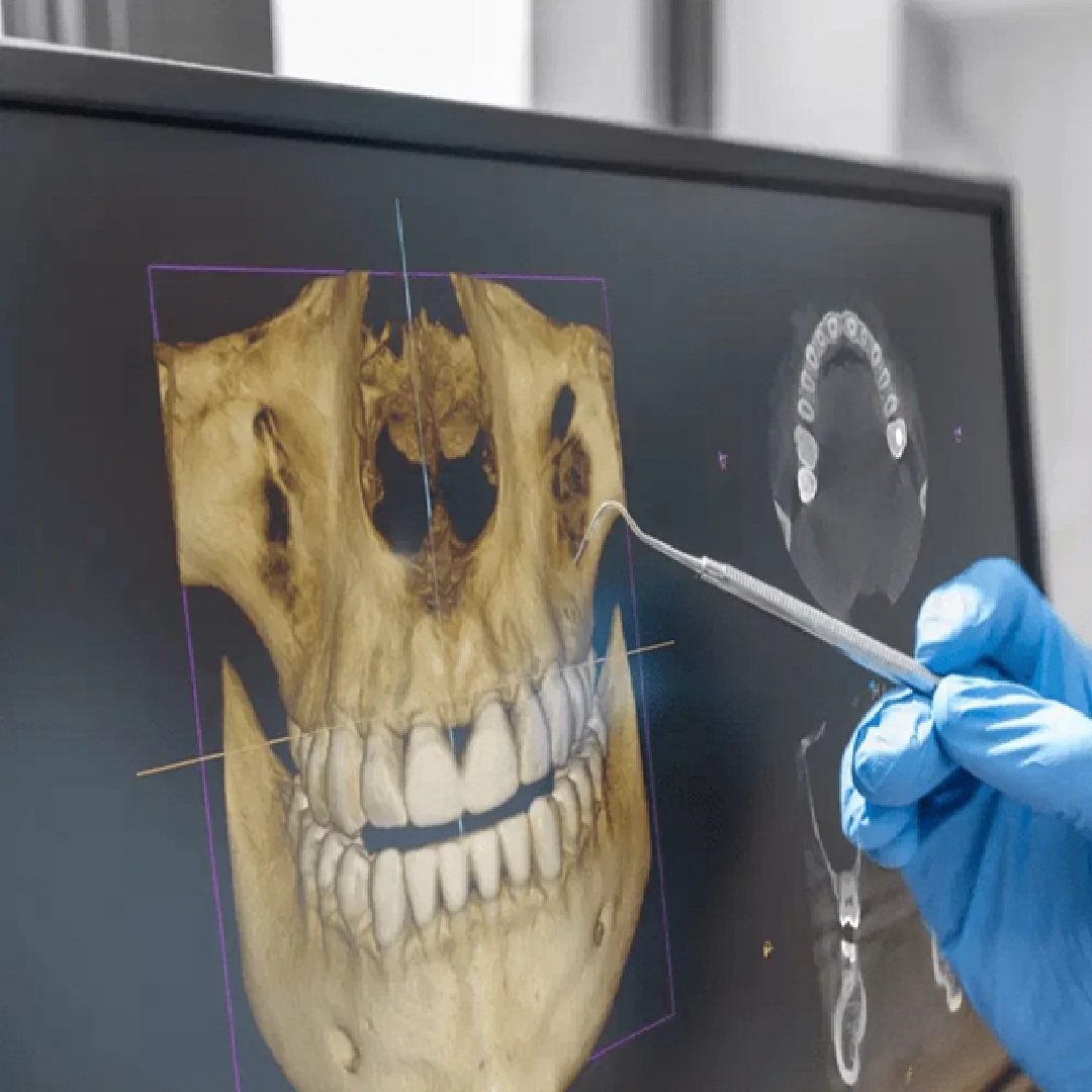 Dental 3D X-Ray Analysis