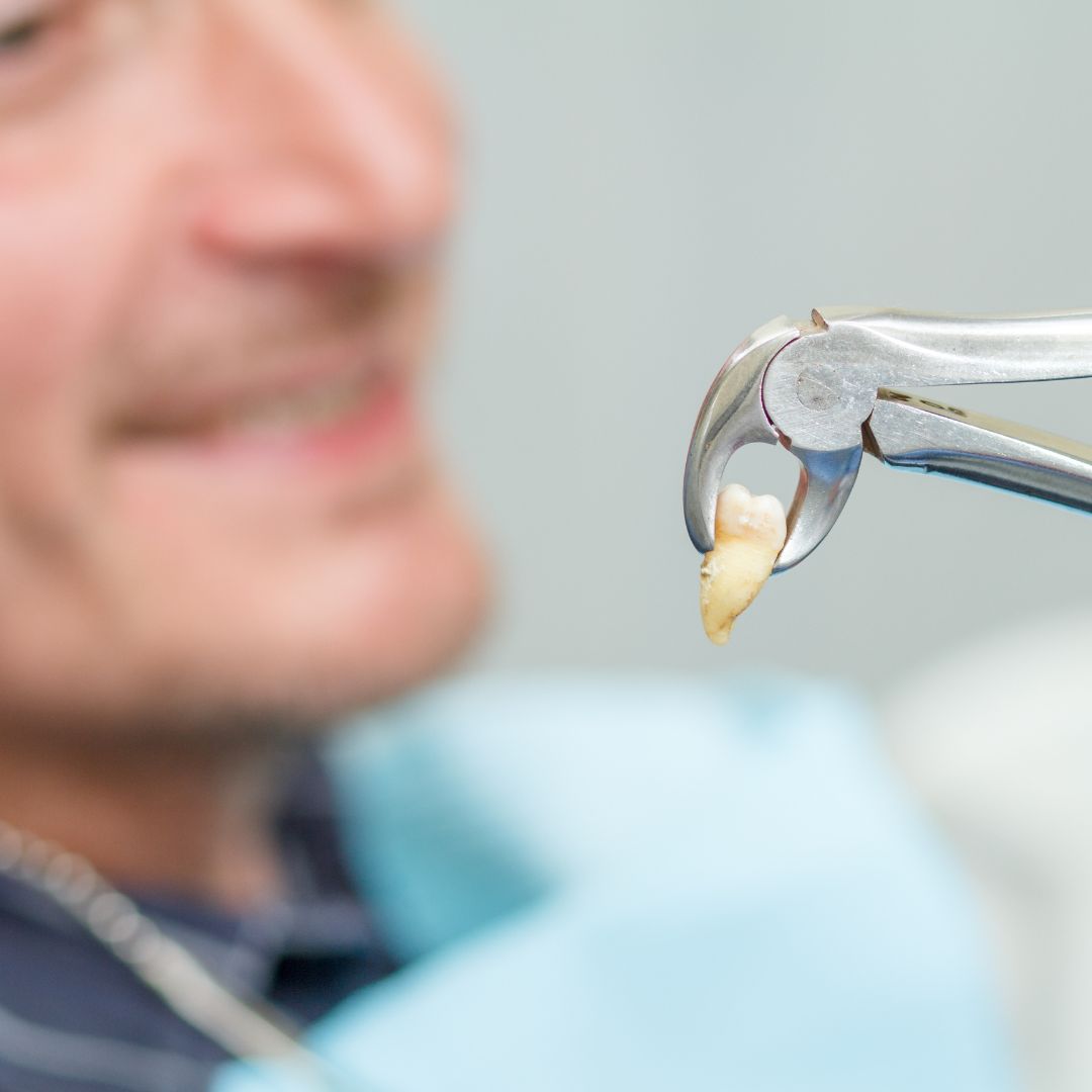 Dentist examining patient for extraction